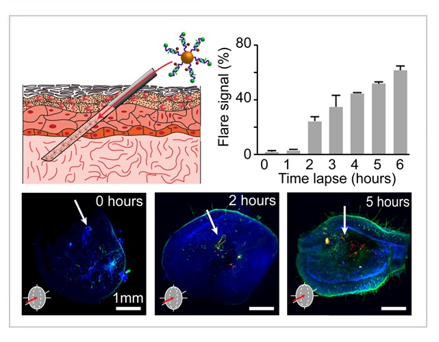 Sensing of Vimentin mRNA