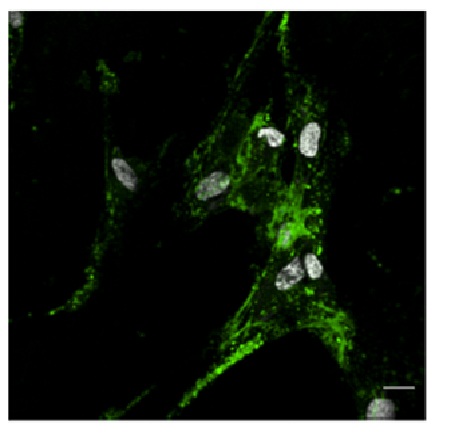 DNA-Gold nanoparticles designed for mRNA sensing in cells: imaging of the gold nanoparticles using two photon photoluminescence spectroscopy