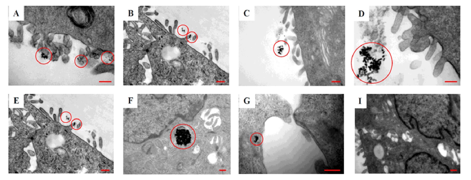 Interactions of gold nanoparticles with biological structures