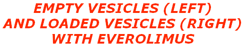 EMPTY VESICLES (LEFT)  AND LOADED VESICLES (RIGHT)  WITH EVEROLIMUS